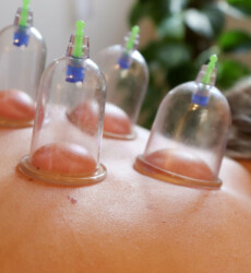 Cupping