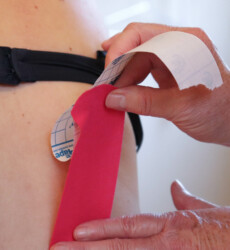 Medical taping